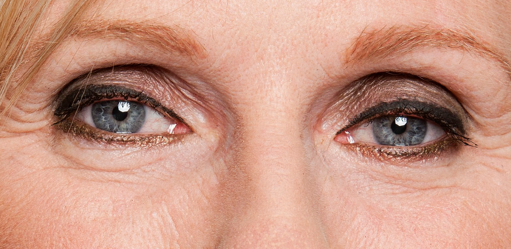 Dit is een afbeelding van na een behandeling van ogen, de wenkbrauwen hebben permanente make-up, door Permanent Mooi